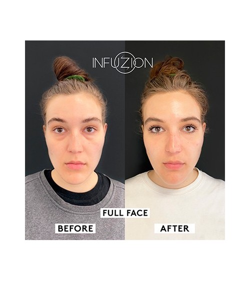 INFUZION System Skin Boozter laitekasvohoito