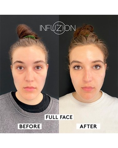 INFUZION Volymizer laitekasvohoito